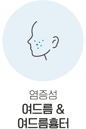 여드름&여드름흉터